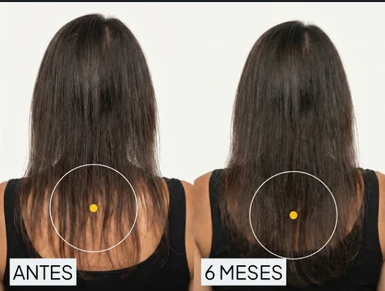 Resultado antes y después compartido por Mariana O.
